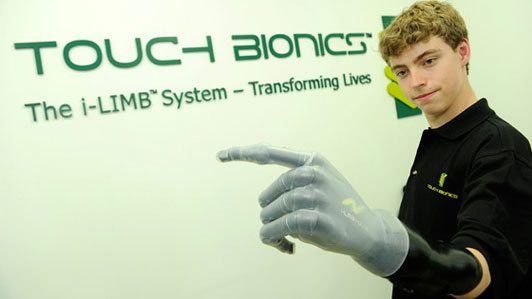 Mercedes F1 Team Builds 14-Year-Old Fan A Bionic Hand Mercedes F1 Team Builds 14-Year-Old Fan A Bionic Hand